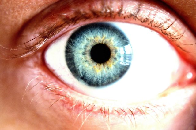 lidské oko,  zelený zákal,  šedý zákal | foto: CC0 Public domain