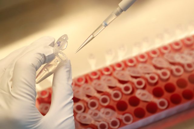 testování,  koronavirus,  vzorky | foto: Anton Vaganov,  Reuters