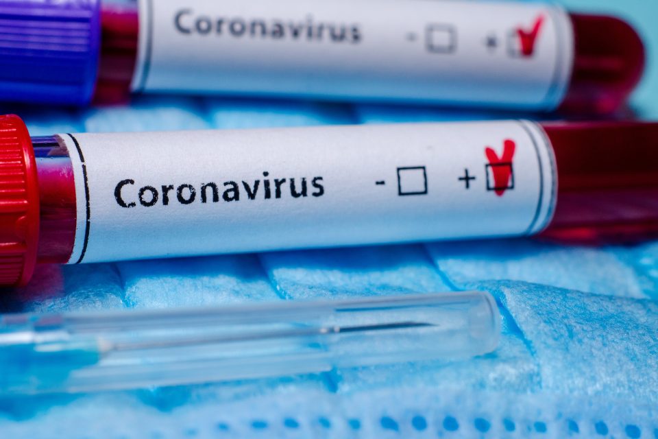 Koronavirus,  vzorek,  test,  laboratoř,  odběr krve,  Covid-19,  nákaza,  ilustrační | foto: Fotobanka Profimedia